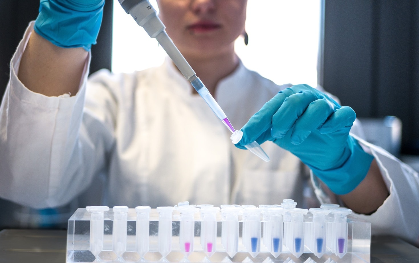 The Future Of Peptide Synthesis Tech